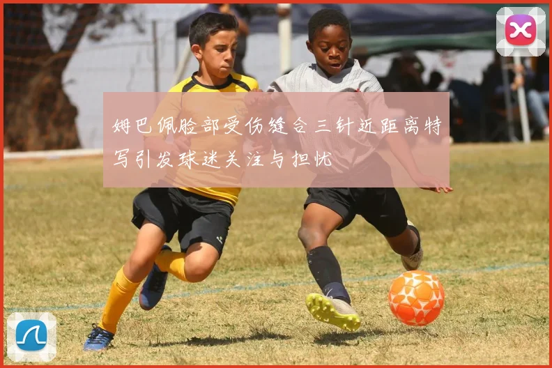 姆巴佩脸部受伤缝合三针近距离特写引发球迷关注与担忧
